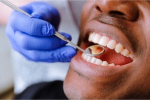 Close up of black male getting fillings